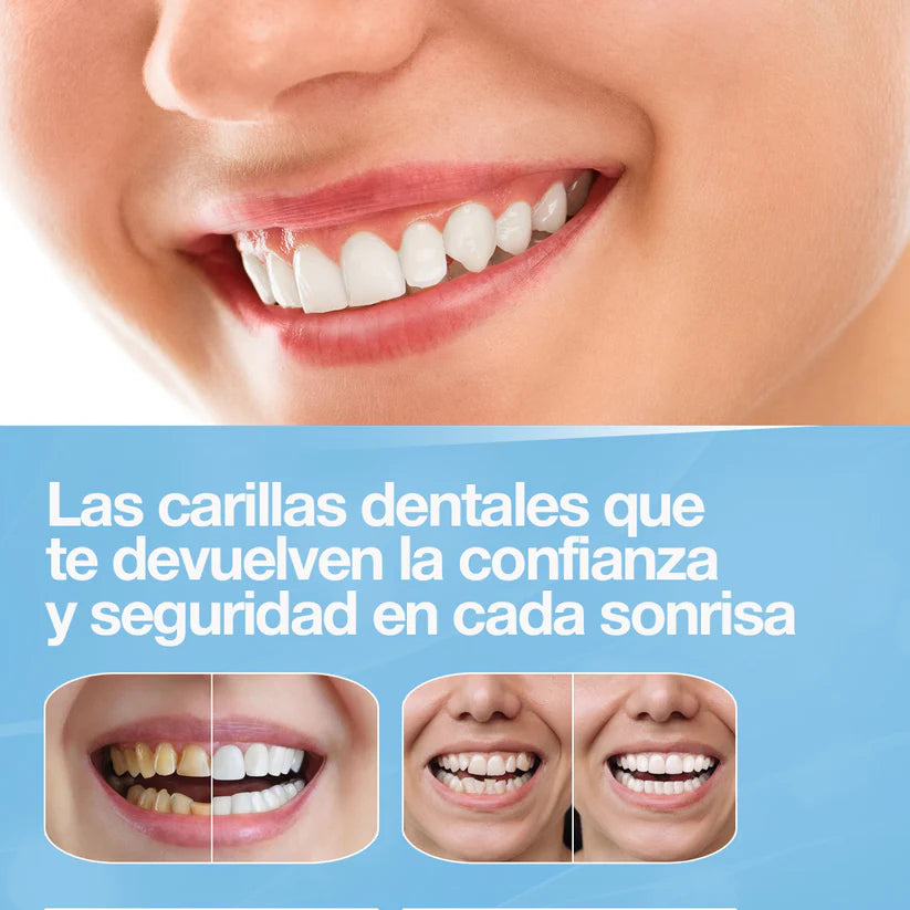 🦷SNAPOM SMILE™ - SONRISA PERFECTA- ¡COMPRA 1 Y LLEVA 2!💥